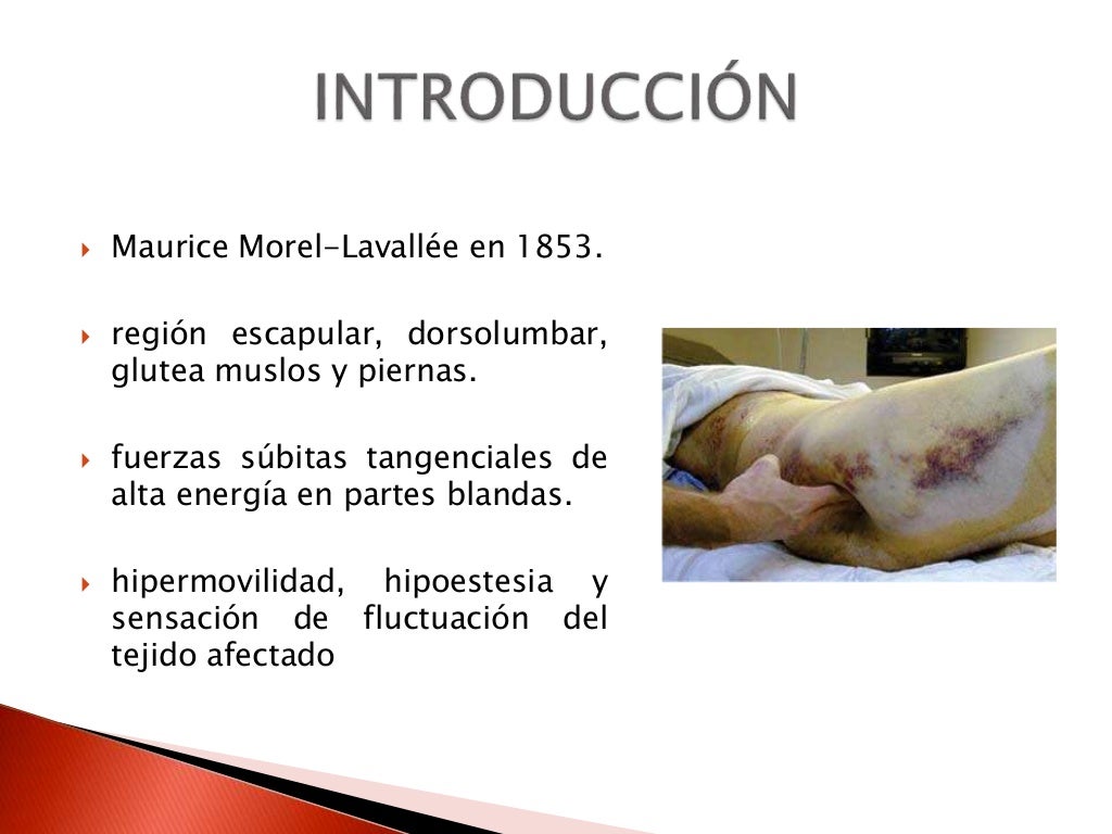 Estudio de la lesion morel lavallee