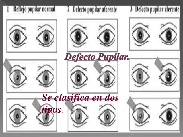 Estudio de la pupila.