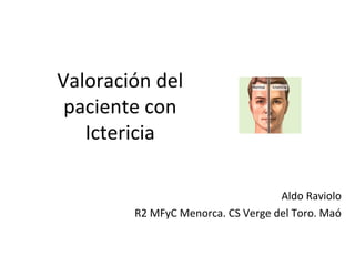 Valoración del
paciente con
Ictericia
Aldo Raviolo
R2 MFyC Menorca. CS Verge del Toro. Maó
 