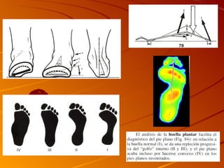 Estudio del pie por Nicolas Laprida TF