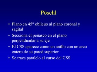 PöschlPlano en 45° oblicuo al plano coronal y sagitalSecciona el peñasco en el plano perpendicular a su ejeEl CSS aparece como un anillo con un arco entero de su pared superiorSe traza paralelo al curso del CSS