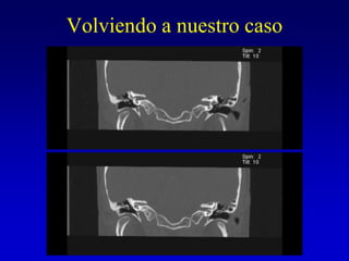 Volviendo a nuestro caso