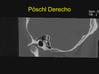 Pöschl Derecho