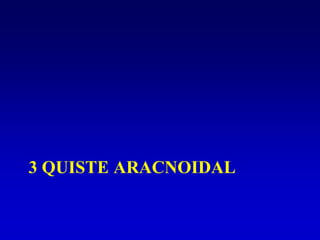 3 QUISTE ARACNOIDAL