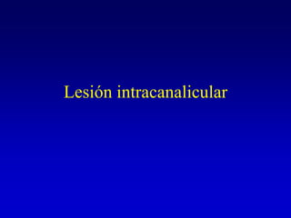 Lesión intracanalicular