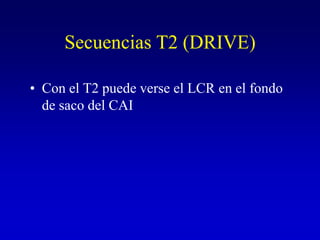 Secuencias T2 (DRIVE)Con el T2 puede verse el LCR en el fondo de saco del CAI 