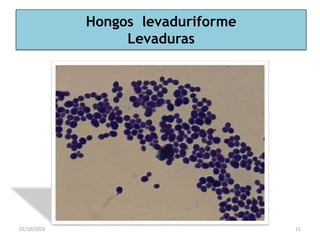 Hongos levaduriforme
Levaduras
01/10/2023 11
 