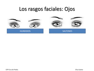 Los rasgos faciales: Ojos

HUNDIDOS

CIFP Cruz de Piedra

SALTONES

Chus Suárez

 