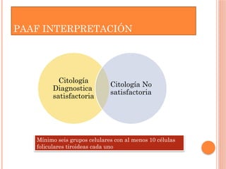 Citología
Diagnostica
satisfactoria
Citología No
satisfactoria
PAAF INTERPRETACIÓN
Mínimo seis grupos celulares con al menos 10 células
foliculares tiroideas cada uno
 