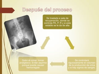 Se traslada a sala de
recuperación, donde se
controla PA, P, R y si esta
estable se le da de alta
Se controlará
rigurosamente el volumen
de la producción de orina
y si hay signos de sangre.
Dolor al orinar, tomar
analgésico. Evitar aspirina
porque puede causar
hemorragias
 