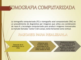 La tomografía computarizada (TC) o tomografía axial computarizada (TAC) es
un procedimiento de diagnóstico por imágenes que utiliza una combinación
de rayos-X y tecnología computarizada para producir imágenes transversales
(a menudo llamadas "cortes") del cuerpo, tanto horizontal como vertical.
Después de la
extirpación de un
riñón
Utilizarse para
localizar masas
anormales en el
espacio vacío donde
antes estaba el riñón
Realizarse después
de un trasplante renal
para evaluar el
tamaño y la ubicación
del nuevo riñón en
relación con la vejiga
 