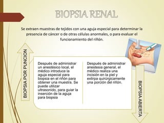 Se extraen muestras de tejidos con una aguja especial para determinar la
presencia de cáncer o de otras células anormales, o para evaluar el
funcionamiento del riñón.
Después de administrar
un anestésico local, el
médico introduce la
aguja especial para
biopsia en el riñón para
obtener una muestra. Se
puede utilizar
ultrasonido, para guiar la
inserción de la aguja
para biopsia
Después de administrar
anestesia general, el
médico realiza una
incisión en la piel y
extirpa quirúrgicamente
una porción del riñón.
BIOPSIAPORPUNCION
BIOPSIAABIERTA
 
