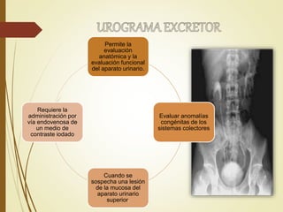 Permite la
evaluación
anatómica y la
evaluación funcional
del aparato urinario.
Evaluar anomalías
congénitas de los
sistemas colectores
Cuando se
sospecha una lesión
de la mucosa del
aparato urinario
superior.
Requiere la
administración por
vía endovenosa de
un medio de
contraste iodado
 