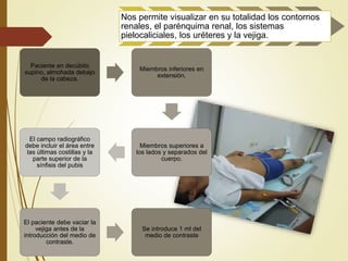 Nos permite visualizar en su totalidad los contornos
renales, el parénquima renal, los sistemas
pielocaliciales, los uréteres y la vejiga.
Paciente en decúbito
supino, almohada debajo
de la cabeza.
Miembros inferiores en
extensión.
Miembros superiores a
los lados y separados del
cuerpo.
El campo radiográfico
debe incluir el área entre
las últimas costillas y la
parte superior de la
sínfisis del pubis
El paciente debe vaciar la
vejiga antes de la
introducción del medio de
contraste.
Se introduce 1 ml del
medio de contraste
 