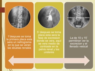 1’despues se toma
la primera placa este
sera un nefrograma
en la que se veran
las siluetas renales
5’ despues se toma
placa esta sera la
fase de excresion
donde se vera, aquí
se vera medio de
contraste en la
pelvis renal y los
ureteres
La de 10 y 15’
permitiran ver la
excrecion y el
llenado vesical
 