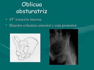 estudio-radiografico-cadera-y-pelvis-ppt
