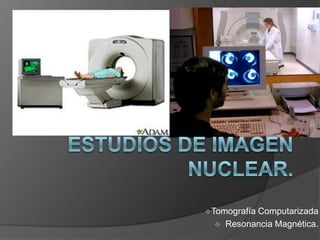 Estudios de imagen nuclear. ,[object Object]