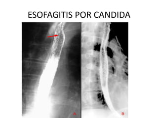 Estudios contrastados gastrointestinales - Dra. Marroqui | PPTX