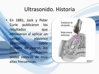 Ultrasonido. Historia
• En 1881, Jack y Peter
Curie publicaron los
resultados que
obtuvieron al aplicar un
campo eléctrico
alternante sobre
cristales de cuarzo, los
cuales produjeron
ondas sonoras de muy
altas frecuencias.
 