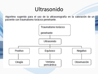 Ultrasonido
 