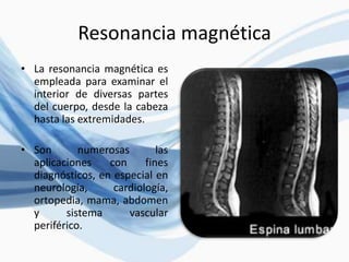 Resonancia magnética
• La resonancia magnética es
empleada para examinar el
interior de diversas partes
del cuerpo, desde la cabeza
hasta las extremidades.
• Son numerosas las
aplicaciones con fines
diagnósticos, en especial en
neurología, cardiología,
ortopedia, mama, abdomen
y sistema vascular
periférico.
 