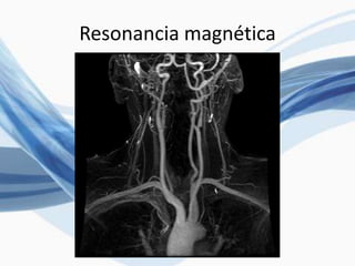 Resonancia magnética
 