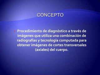  Procedimiento de diagnóstico a través de
imágenes que utiliza una combinación de
radiografías y tecnología computada para
obtener imágenes de cortes transversales
(axiales) del cuerpo.
 