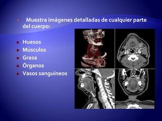  Muestra imágenes detalladas de cualquier parte
del cuerpo:
 Huesos
 Músculos
 Grasa
 Órganos
 Vasos sanguíneos
 