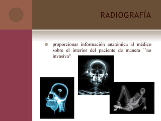 RADIOGRAFÍA
 proporcionar información anatómica al médico
sobre el interior del paciente de manera ``no
invasiva''
 