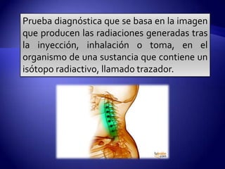 Prueba diagnóstica que se basa en la imagen
que producen las radiaciones generadas tras
la inyección, inhalación o toma, en el
organismo de una sustancia que contiene un
isótopo radiactivo, llamado trazador.
 
