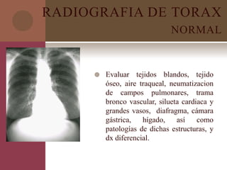 RADIOGRAFIA DE TORAX
NORMAL
 Evaluar tejidos blandos, tejido
óseo, aire traqueal, neumatizacion
de campos pulmonares, trama
bronco vascular, silueta cardiaca y
grandes vasos, diafragma, cámara
gástrica, hígado, así como
patologías de dichas estructuras, y
dx diferencial.
 