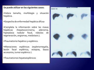 Se puede utilizar en los siguientes casos:
•Valora tamaño, morfología y situación
hepática.
•Sospecha de enfermedad hepática difusa
•Completa la información sobre las masas
hepáticas (hepatocarcinoma, adenoma,
hiperplasia nodular focal, nódulos de
regeneración, angiomas, metástasis ).
•Traumatismo hepático y esplénico.
•Alteraciones esplénicas (esplenomegalia,
lesión focal esplénica, ectopias, bazos
accesorios, tumor esplénico ).
•Traumatismos hepatoesplénicos
 