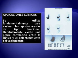 APLICACIONES CLÍNICAS
Se utiliza
fundamentalmente para
evaluar las gastroparesias
de tipo funcional.
Habitualmente existe una
pobre correlación entre la
clínica y el enlentecimiento
del vaciamiento.
 