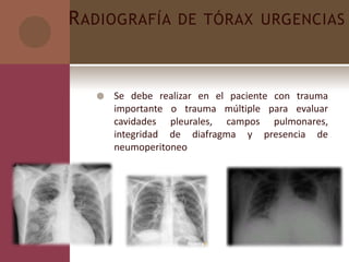 RADIOGRAFÍA DE TÓRAX URGENCIAS
 Se debe realizar en el paciente con trauma
importante o trauma múltiple para evaluar
cavidades pleurales, campos pulmonares,
integridad de diafragma y presencia de
neumoperitoneo
 