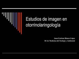 Estudios de imagen en
otorrinolaringología
Juan Esteban Blanco López
R1 de Medicina del Trabajo y Ambiental
 