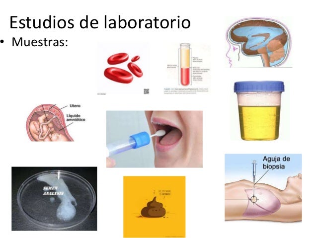 Estudios de laboratorio Estudios de laboratorio