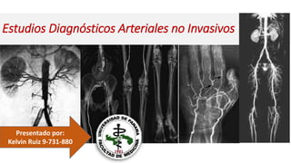 Estudios Diagnósticos Arteriales no Invasivos
Presentado por:
Kelvin Ruiz 9-731-880
 