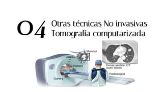 Otras técnicas No invasivas
Tomografía computarizada
04
 