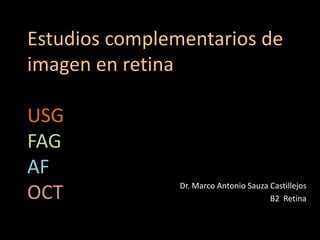 Estudios complementarios de
imagen en retina
USG
FAG
AF
OCT Dr. Marco Antonio Sauza Castillejos
B2 Retina
 