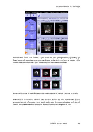 Estudios Isotópicos en Cardiología




Reorientar los cortes axial, coronal y sagital en los tres ejes: eje largo vertical, eje corto y eje
largo horizontal respectivamente, procurando que ambas series, esfuerzo y reposo, estén
alineadas de la misma manera, para poder comparar mejor ambas imágenes.




Presentar el display de las imágenes comparativas de esfuerzo - reposo y archivar el estudio.


El facultativo, a la hora de informar estos estudios dispone de otras herramientas que le
proporcionan más información como son la elaboración de mapas polares de perfusión, el
análisis del acortamiento miocárdico y de la cinética ventricular (imágenes en cine).




                                                       Natacha Sánchez Bueno                     12
 