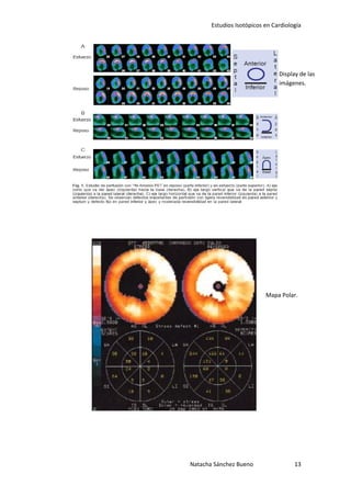 Estudios Isotópicos en Cardiología




                                Display de las
                                imágenes.




                           Mapa Polar.




Natacha Sánchez Bueno                 13
 