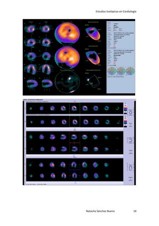 Estudios Isotópicos en Cardiología




Natacha Sánchez Bueno                 14
 