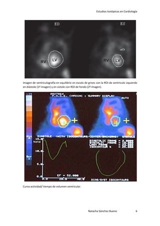 Estudios Isotópicos en Cardiología




Imagen de ventriculografía en equilibrio en escala de grises con la ROI de ventrículo izquierdo
en diástole (1ª imagen) y en sístole con ROI de fondo (2ª imagen).




Curva actividad/ tiempo de volumen ventricular.




                                                      Natacha Sánchez Bueno                  6
 