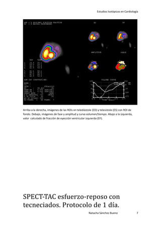 Estudios Isotópicos en Cardiología




Arriba a la derecha, imágenes de las ROIs en telediástole (ED) y telesístole (ES) con ROI de
fondo. Debajo, imágenes de fase y amplitud y curva volumen/tiempo. Abajo a la izquierda,
valor calculado de fracción de eyección ventricular izquierda (EF).




SPECT-TAC esfuerzo-reposo con
tecneciados. Protocolo de 1 día.
                                                       Natacha Sánchez Bueno                   7
 