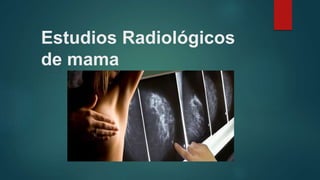 Estudios Radiológicos
de mama
 