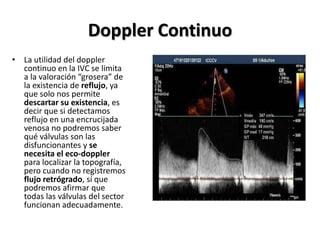 Doppler Continuo
• La utilidad del doppler
continuo en la IVC se limita
a la valoración “grosera” de
la existencia de reflujo, ya
que solo nos permite
descartar su existencia, es
decir que si detectamos
reflujo en una encrucijada
venosa no podremos saber
qué válvulas son las
disfuncionantes y se
necesita el eco-doppler
para localizar la topografía,
pero cuando no registremos
flujo retrógrado, sí que
podremos afirmar que
todas las válvulas del sector
funcionan adecuadamente.
 