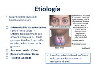 Etiología
• Las principales causas del
  hipertiroidismo son:

① Enfermedad de Basedow-Graves
  ( Bocio Tóxico Difuso) –
  Enfermedad autoinmune que
  provoca hiperplasia del tejido
  glandular tiroideo  secreción
  excesiva de hormonas por la
  glándula
② Adenoma tiroideo tóxico
③ Bocio multinodular tóxico      • La enfermedad de Basedow-Graves
④ Tiroiditis subaguda              es la causa más común y más
                                   frecuente  80%
 