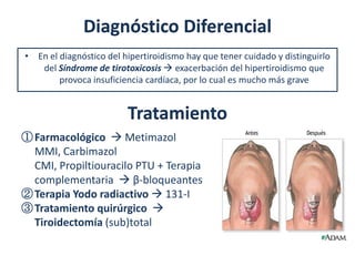 Diagnóstico Diferencial
• En el diagnóstico del hipertiroidismo hay que tener cuidado y distinguirlo
   del Síndrome de tirotoxicosis  exacerbación del hipertiroidismo que
        provoca insuficiencia cardíaca, por lo cual es mucho más grave


                         Tratamiento
① Farmacológico  Metimazol
  MMI, Carbimazol
  CMI, Propiltiouracilo PTU + Terapia
  complementaria  β-bloqueantes
② Terapia Yodo radiactivo  131-I
③ Tratamiento quirúrgico 
  Tiroidectomía (sub)total
 