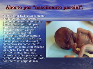Aborto por “nascimento parcial”: O aborto por ECI (esvaziamento craniano intra-uterino), ou aborto com nascimento parcial, é uma técnica utilizada para provocar o aborto quando a gravidez está em estágio avançado. Guiado por ultrassom, o médico agarra a perna do feto com um fórceps, puxa-a para o canal vaginal, e então puxa seu corpo inteiro para fora do útero, com exceção da cabeça. Faz então uma incisão na nuca, inserindo depois um catéter para sugar o cérebro do bebê e então retirá-lo por inteiro do corpo da mãe. 
