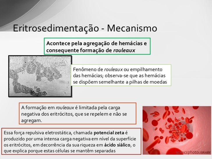 Estudo da velocidade de hemossedimentação (vhs) Estudo da velocidade de hemossedimentação (vhs)